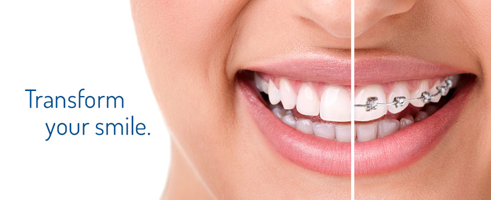 Orthodontist-Ryde