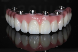 Picture10