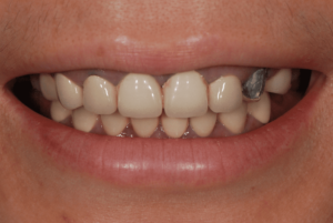 Picture6