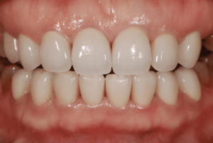 Picture8