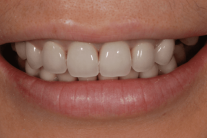 Picture9